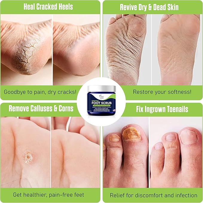Exfoliating Foot Scrub with Pumice Stone Powder - Gentle Moisturizing Foot Scrub for Dry Skin - Cracked Heel Repair for Smooth, Soft Feet - Pedicure Foot Spa 2 Pack