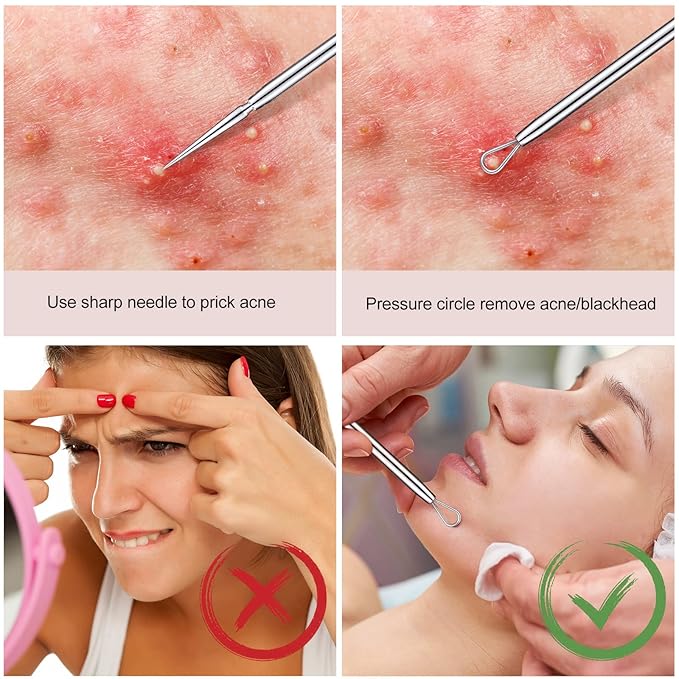 Titanium Lancet Needle Pimple Popper Tool Facial Milia Remover Blackhead Blemish Remover Blackhead Whitehead Extractor Professional Lancet Zit Blemish Comedone Removal Tool 2 Pieces with Box