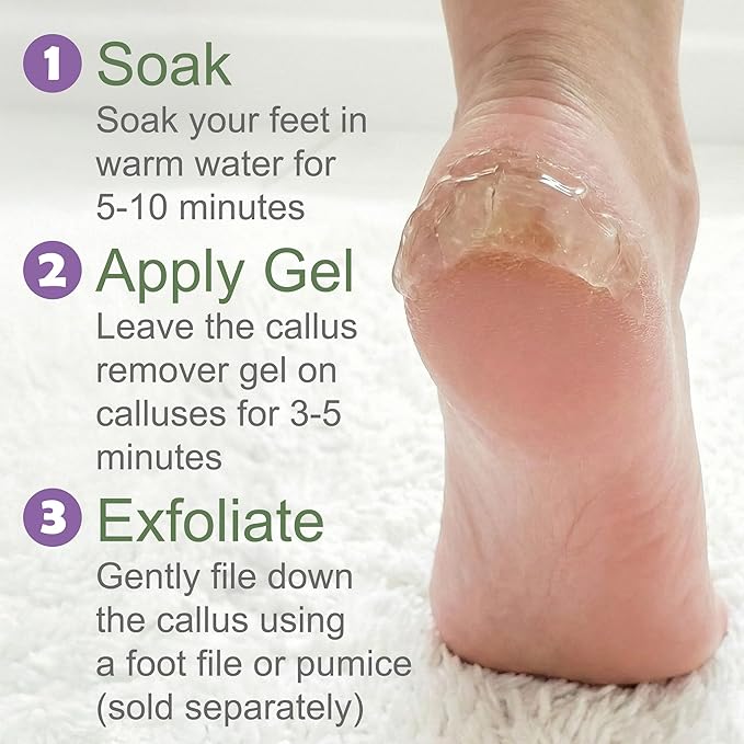 Dr. Entre's 16oz Callus Remover Gel: Extra Strength Value Size, Callus Remover for Feet, Pedicure Tools Supplies, Dead Skin Remover, Foot Care