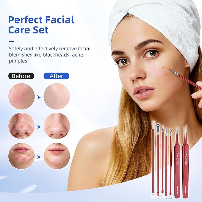 Shevelestar 7PCS Blackhead Remover Comedone Extractor, Curved Blackhead Tweezers Kit, Professional Stainless Pimple Acne Blemish Removal Tools Kit