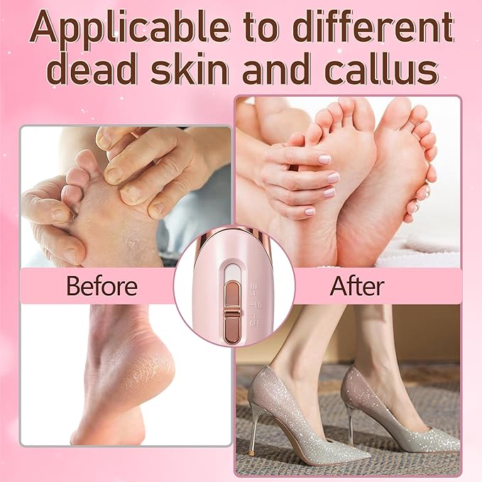 Callus Remover for Feet，Electric Foot Callus Remover with 2 Rollers 2 Speed,16 in1 Rechargeable Foot File Pedicure Kits for Dead Hard Cracked Dry Skin