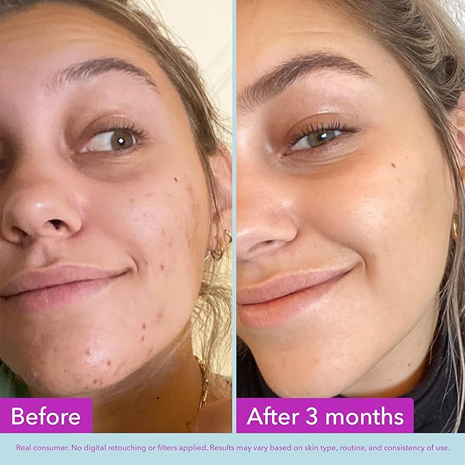 Good Molecules Niacinamide Brightening Toner - Toner for Face with Niacinamide and Arbutin for Skin Tone Balancing- Pore Minimizer, Facial Skin Care