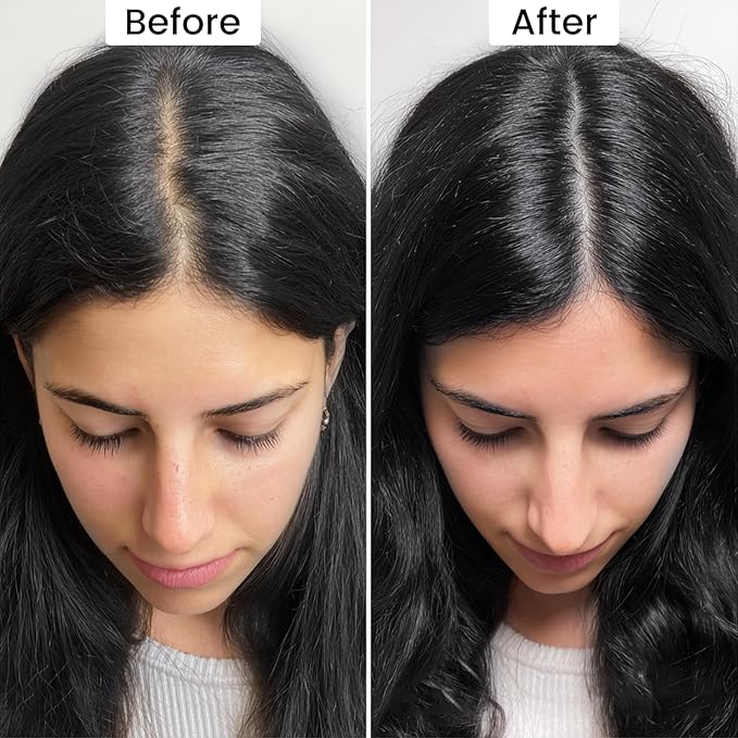 VOLLUCK Root Touch up Powder, Instant Hairline Powder for Thinning Areas and Gray Hair Coverage, Natural and Non-greasy Root Cover up for Women and Men (Black, 0.35 Ounce)