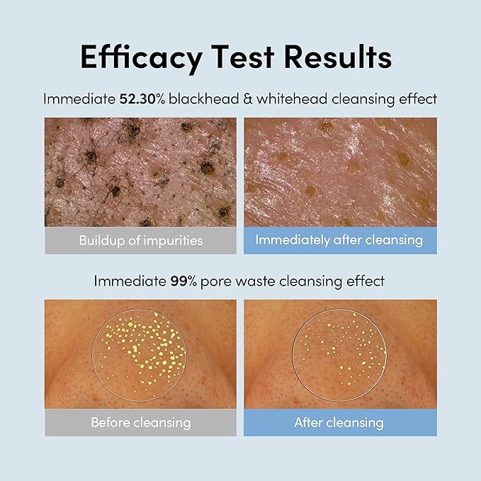 LAGOM Micro Pore Cleansing Oil, Daily Lightweight Makeup Blackhead Remover for Face, Korean Skincare 6.76 Fl Oz