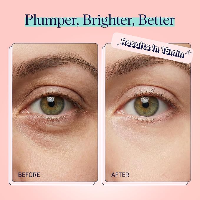 SpaLife Watermelon Cooling Eye Pads, 48 Hydrating Under Eye Patches for Puffiness, Dark Circles, and Tired Eyes, Infused with Hyaluronic Acid, Glycerin, and Vitamin C, Fruity Scent