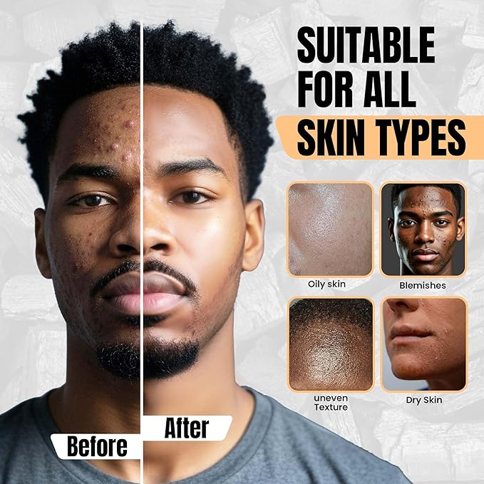Men’s Charcoal Exfoliating Face Scrub – Gritty Facial Cleanser With Pumice & Sugar - For Blackheads, Oil Control, Acne, Rough Skin, Clogged Pores & Post-Shave Bumps