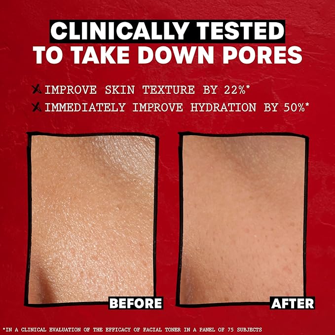 THAYERS Alcohol-Free Rose Petal Witch Hazel Facial Toner for Glowing Skin, Soothing, Hydrating, Refreshing Toner for Normal and Combination Skin, 3oz