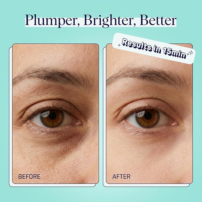 SpaLife Cooling Cucumber Eye Pads | Korean Dark Circles & Puffy Eyes Treatment | Nourishing Cucumber Eye Pads | Eye Mask for Puffy Eyes Daily Depuffing Eye Patches | 48 Count