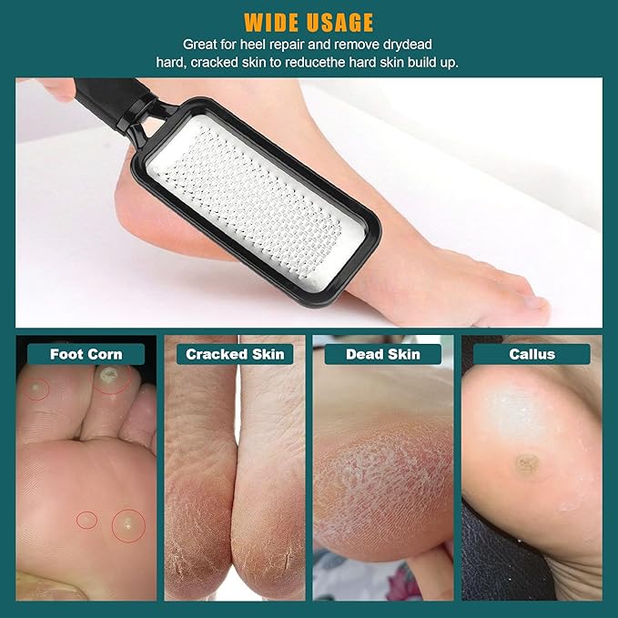 Foot Files Foot Scrubber Pedicure, Stainless Steel Callus Remover for Feet, Professional Foot Grater Rasp Scraper to Hard Skin Corns for Dry and Wet Fee