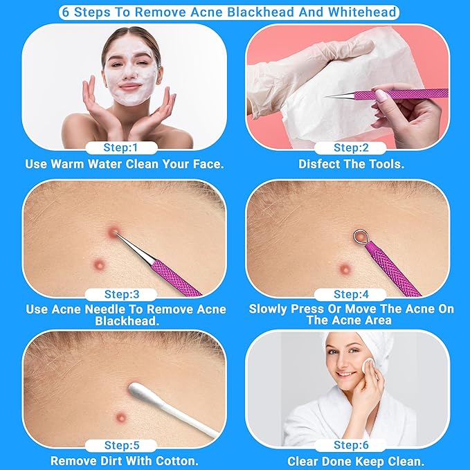 EFAH Care 2Pcs Stainless Steel Pimple Extractor Acne Treatment Tool Surgical Blemish Grade Blackhead Remover Perfect for face and Nose Easy to Clean (Pink)