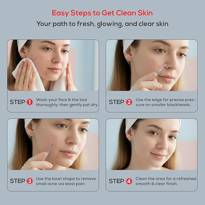 Suvorna Comedone Extractor 2in1, Milia Remover, Nose Blackhead Remover Tool, Whitehead Extractor, Pore Extractor, Black Head Remover for Face, Pore Cleaner, Pimple Popper Tool, Pimple Extractor