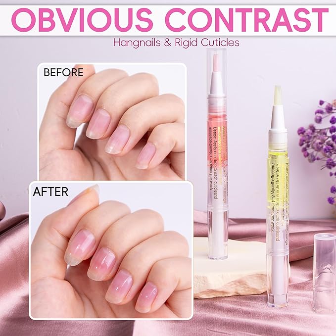 2PCS Cuticle Oil Pen for Nails,Nail Oil Pen for Nail Care,Cuticle Oil for Nails with Nail File,Nail Oil Cuticle Prevent Dry Cracking and Hangnails,Deep Nourishment(Cherry & Lemon Flavor)