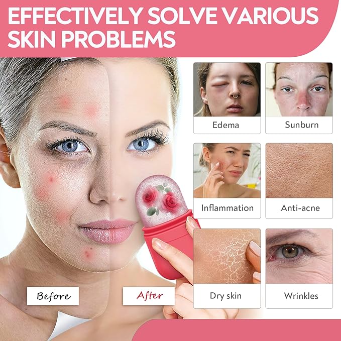 AURUZA 2PCS Ice Roller for Face and Eye, Ice Facial Roller Beauty Self Skin Care Tools Ice Holder Facial Cube Gua Sha Face Massage Ice Mold for Face Anti Wrinkle Tighten Skin Women Gifts…