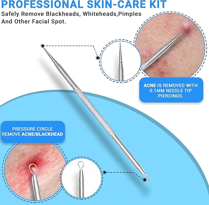 EFAH Care 2Pcs Stainless Steel Pimple Extractor Acne Treatment Tool Surgical Blemish Grade Blackhead Remover Perfect for face and Nose Easy to Clean (Silver)