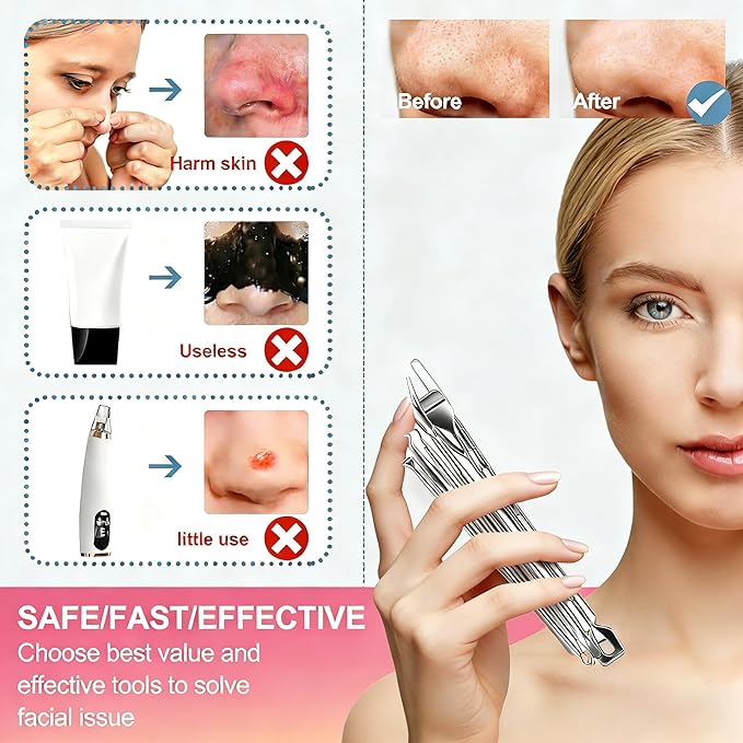 60PCS Pimple Popper Tool Kit, Professional Blackhead Remover for Face, Stainless Steel Pimple Extractor Set, Blackhead Remover Tweezers for Acne, Whitehead, and Blemish Treatment