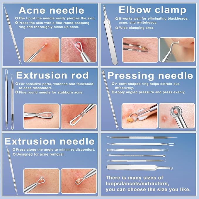 Pimple Extractor Tools, 6-PCS Professional Stainless Steel Blackheads, Whiteheads, Pimples, Boils, Stray Hairs Remover Tools Set with Mirror and Product User Manual, 18-Month Replacement Warranty！