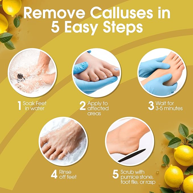 DeEnti Callus Remover for Feet, Extra Strength Foot Callus Remover Gel, 16oz Salon Grade Home Pedicure Supplies for Dry Skin, Cracked Heel, Professional Strength Foot Care, Lemon