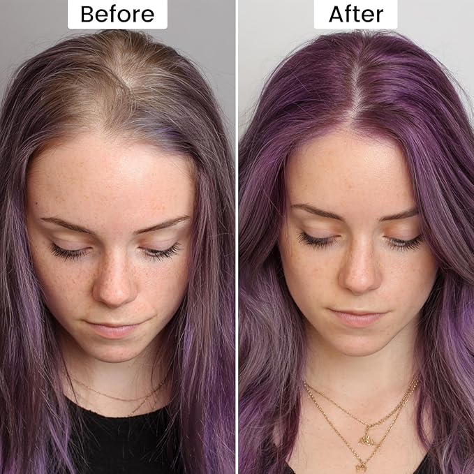 VOLLUCK Root Touch up Powder, Instant Hairline Powder for Thinning Areas and Gray Hair Coverage, Natural and Non-greasy Root Cover up for Women and Men (Purple, 0.14 Ounce)
