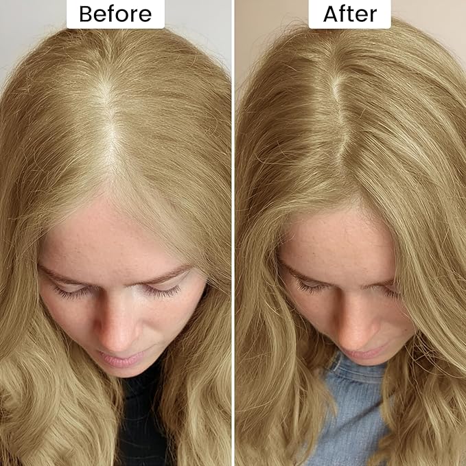 VOLLUCK Root Touch up Powder, Instant Hairline Powder for Thinning Areas and Gray Hair Coverage, Natural and Non-greasy Root Cover up for Women and Men (Blonde, 0.14 Ounce)