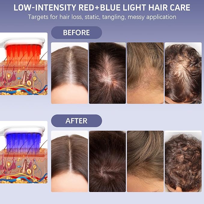 Karrong Hair Scalp Massager Comb, Red Blue Light Therapy Hair Care Brush, Automatic Vibrating Head Massage Comb for Men & Women