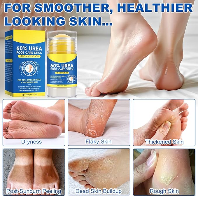 60% Urea with 2% Salicylic Acid Urea Foot Care Stick, 2PCS Heel Stick for Cracked Feet, Foot Care Cream Moisturizer for Dry Cracked Feet, Knees, Elbows, Hands