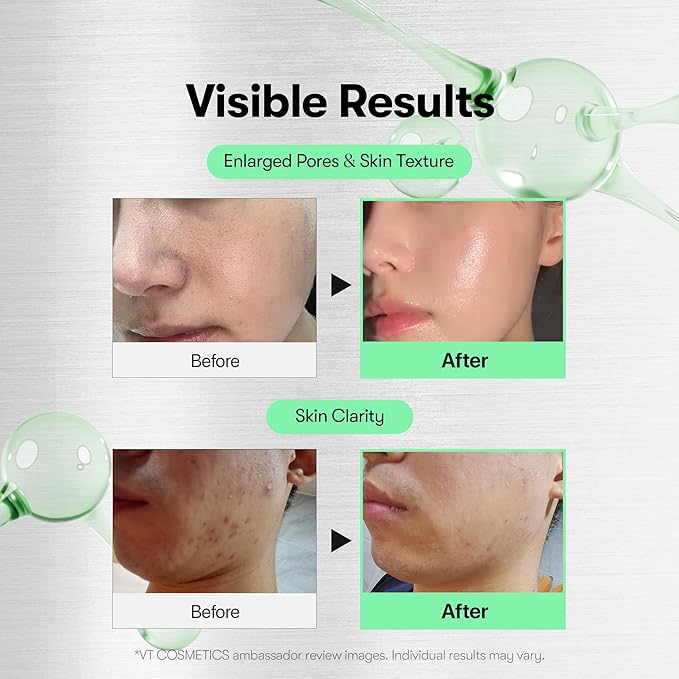 VT COSMETICS CICA Reedle Shot 700, Spicule Microneedling Serum for Pore Care&Exfoliation, Exosome&Centella Asiatica for Glass Skin, Acne&Blemish Care, Korean Liquid Skin Booster (1 Fl Oz / 30ml)