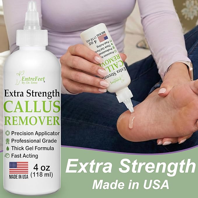 Dr. Entre's Callus Remover Gel & Foot File: Extra Strength Callus Remover for Feet, Foot Callus Remover Care, Pedicure Tools Supplies, Spa Kit, Dead Skin Scrubber, 4 oz