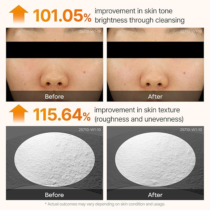 Dr. Melaxin Peel Shot Kojic Acid Turmeric Serum – Exfoliating Dark Spot Corrector with AHA/BHA & Niacinamide, Brightening & Even Tone Facial Serum (80ml / 2.70 fl oz)