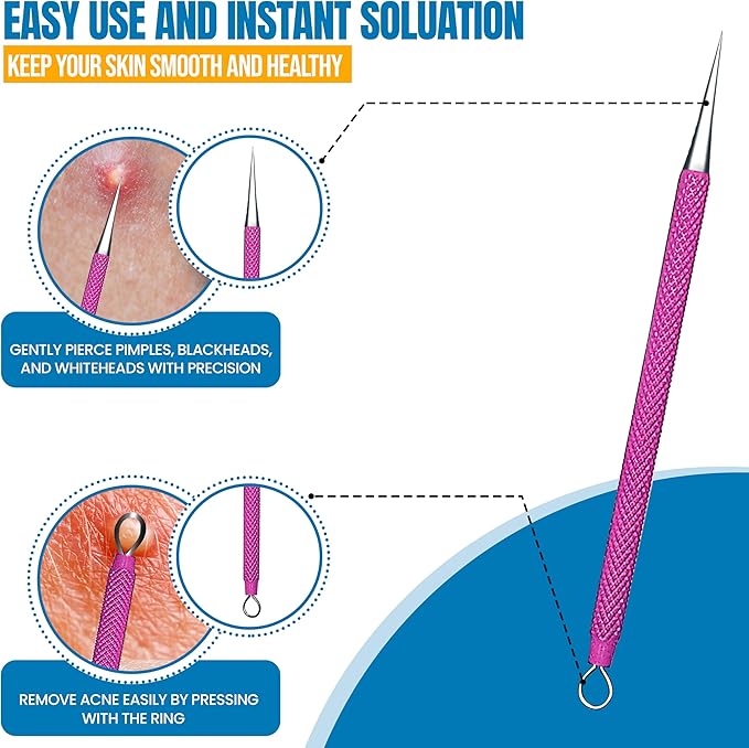 EFAH Care 2Pcs Stainless Steel Pimple Extractor Acne Treatment Tool Surgical Blemish Grade Blackhead Remover Perfect for face and Nose Easy to Clean (Pink)