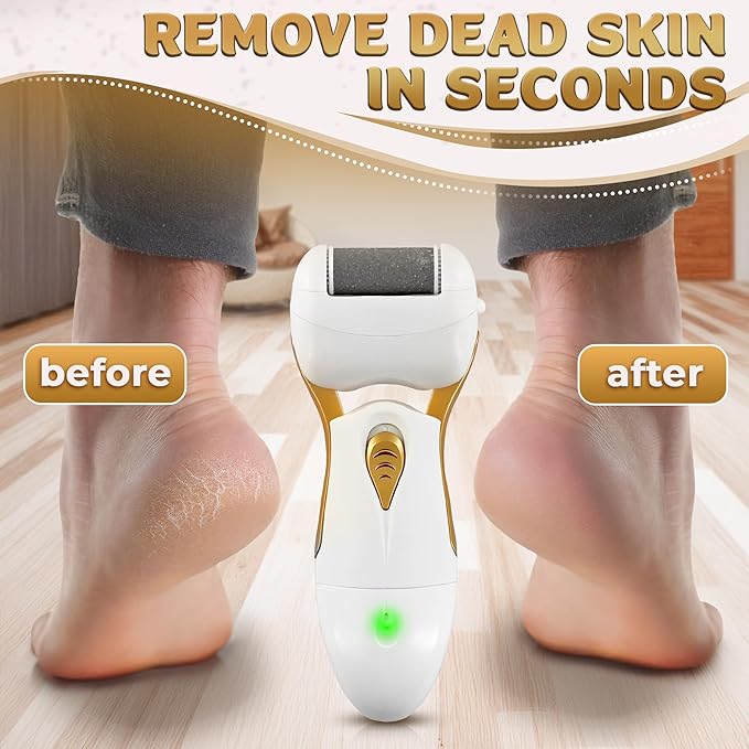 Electric Callus Remover for Feet – Electric Foot Filer with 3 Replacement Rollers & 360° Rotating Head – Hard Skin Remover for Feet with Ergonomic Handle for Easy Grip & Control in Home Pedicure