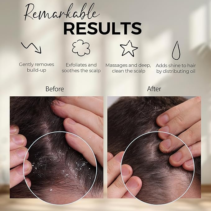 Fiora Naturals Scalp Massager Shampoo Brush - Silicon Scalp Scrubber & Exfoliator for Dandruff Removal and Hair Growth, Brush for Wet & Dry Hair, for Men, Women, Kids - BPA Free