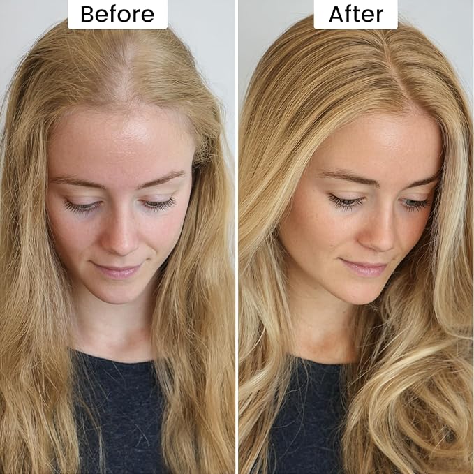VOLLUCK Root Touch up Powder, Instant Hairline Powder for Thinning Areas and Gray Hair Coverage, Natural and Non-greasy Root Cover up for Women and Men (Medium Blonde, 0.35 Ounce)