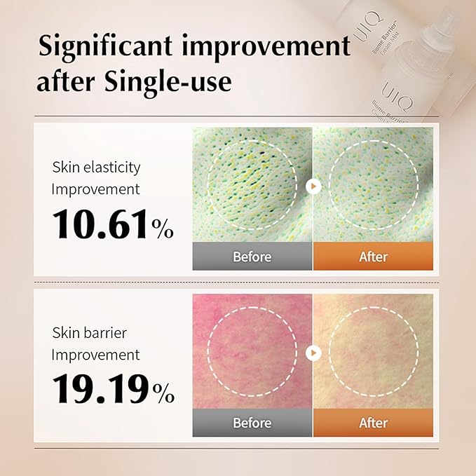 UIQ Biome Barrier Cream Mist, Skin Microbiome-Powered Face Mist with Hyaluronic Acid & Niacinamide for Deep Hydration, Glow & Soothing, Korean Skin Care, 100ml / 3.38 fl. oz.
