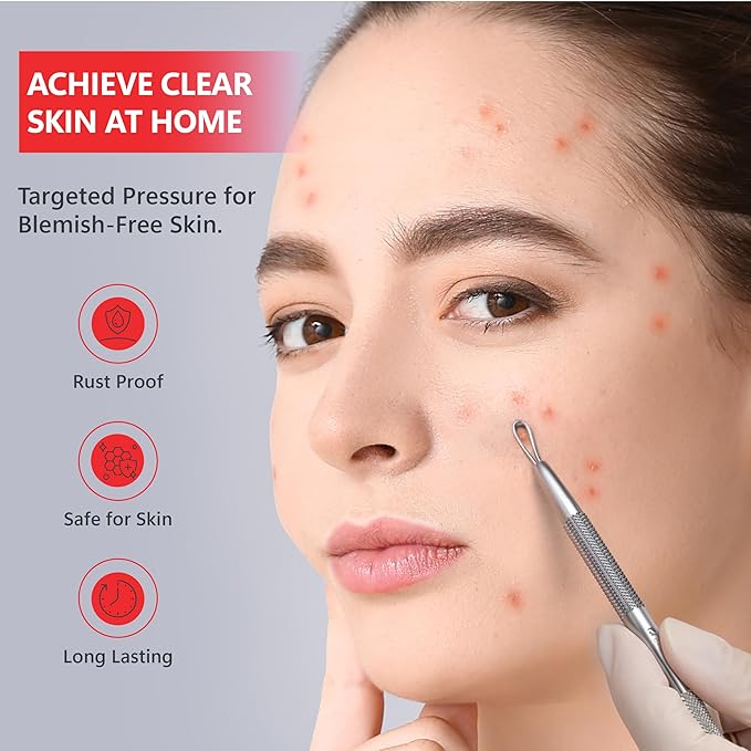 Suvorna White Head Remover for Face, Pimple Extractor, Pimple Popper, Whitehead Remover for Face, Comedone Extractor Tool, Pimple Extractor Tool, Pimple Popper Tool.