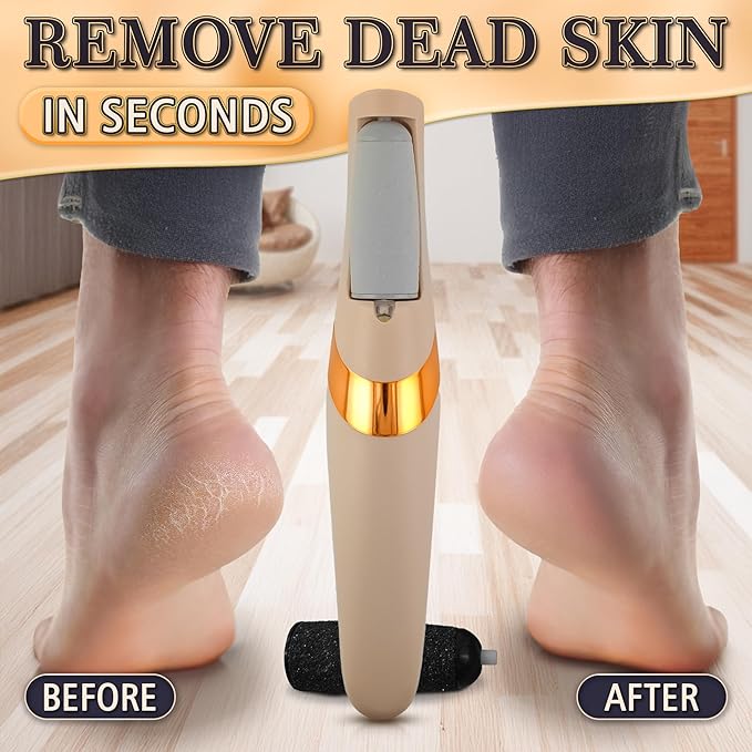 Foot Callus Remover Electric – Callus Grinder for Feet with 2-Speed and 2 Rollers (Coarse & Fine) for Smooth & Soft Feet, Easy to Clean – Compact Electric Foot Sander for Daily Foot Care & Travel Use