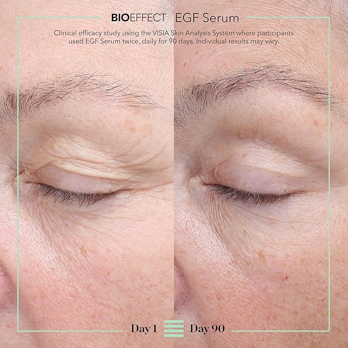 BIOEFFECT EGF Serum | Epidermal Growth Factor + Hyaluronic Acid | Age-Defying Face Treatment for Fine Lines & Wrinkles, Hydration & Firmness, 20 mL / 0.68 oz